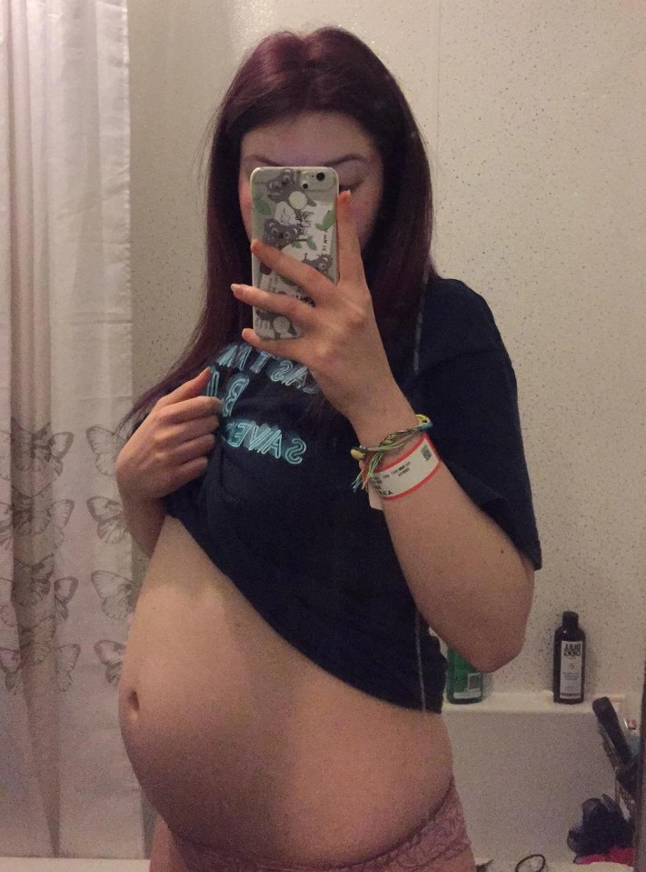 Courtney Harvey, 21, was terrified when an emergency scan at 22 weeks revealed she had a womb infection that was poisoning her daughter