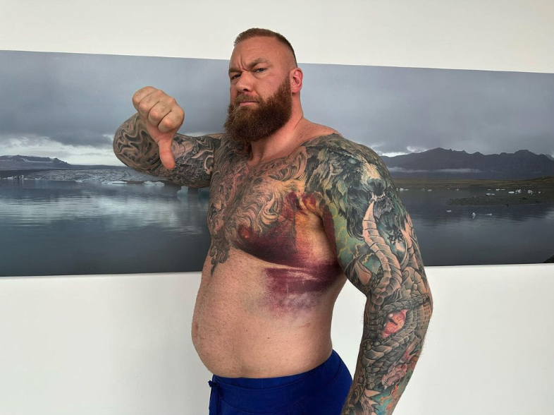 Hafthor Bjornsson is anxiously awaiting surgery on April 26 but says he's regained movement and feels reasonably comfortable