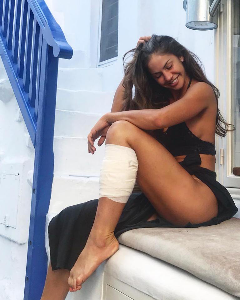 Avril Mathie hurt her leg after being hit by a motorbike