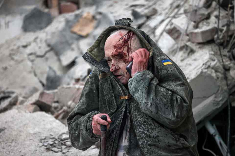 An injured man talks on a phone after he was rescued by emergency workers from a partially destroyed apartment building, less than 30 miles from Bakhmut