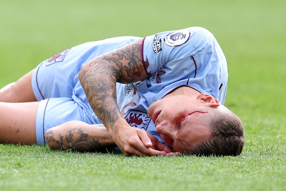 Lucas Digne was left with a nasty cut on his face