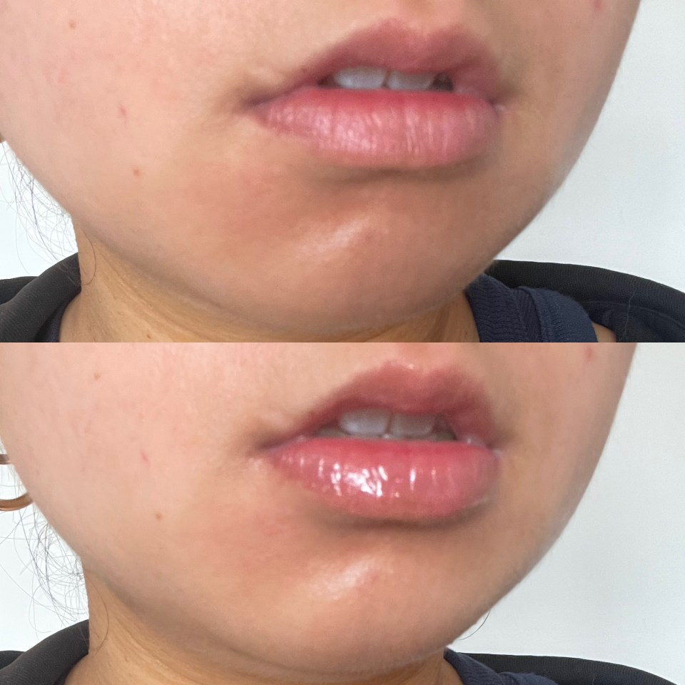 Before and after applying the lip oil on natural lips.