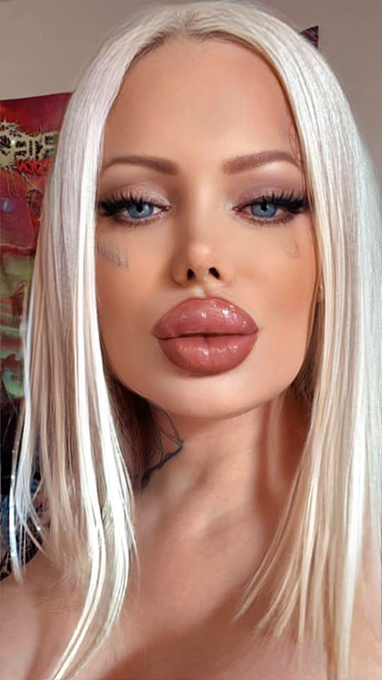 Sabrina Sabrok is to have her 53rd operation