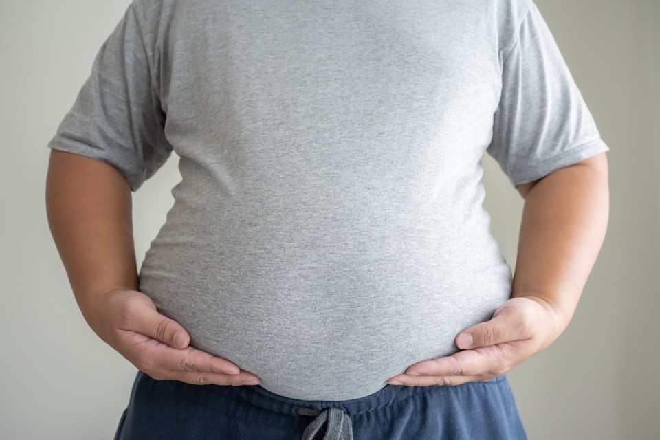 Obese people should be described as patients with "chronic appetite dysregulation", experts say