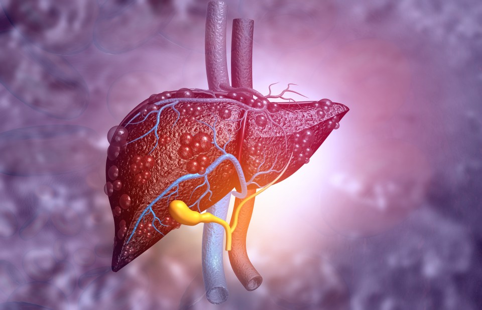 There are often no symptoms of non-alcohol related fatty liver disease