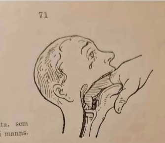 First aid course book from 1943: how to save someone from choking