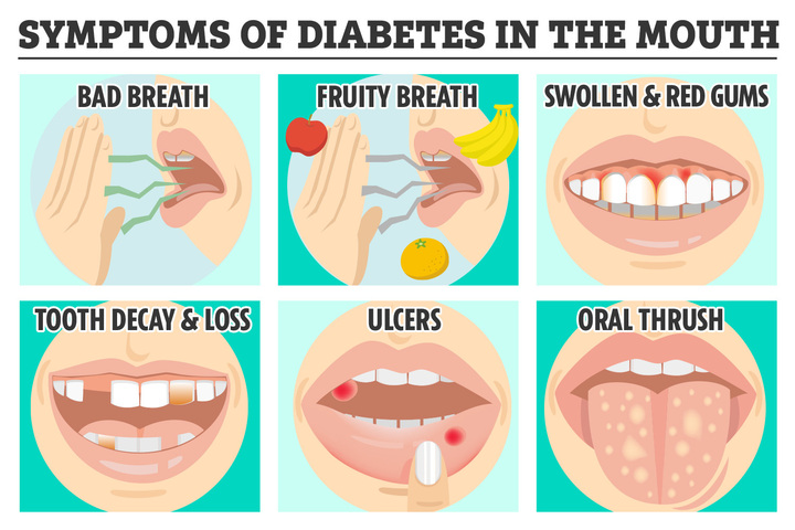 The 6 red flag signs of diabetes you can find in your mouth