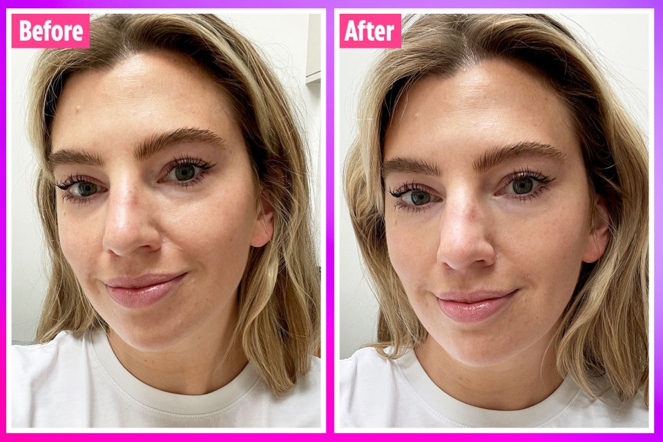 Laura noticed a marked difference after using the cream, and the effects lasted all day