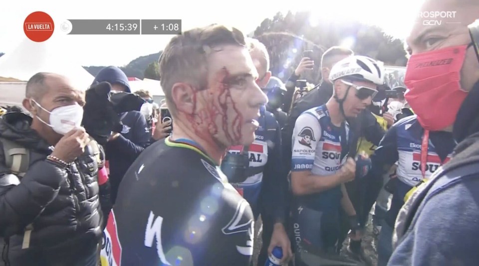 Evenepoel could be seen covered in blood following the incident