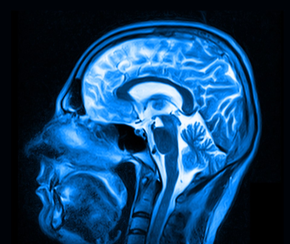 Scientists used brain scans and found the hypothalamus was bigger in overweight people (stock image)