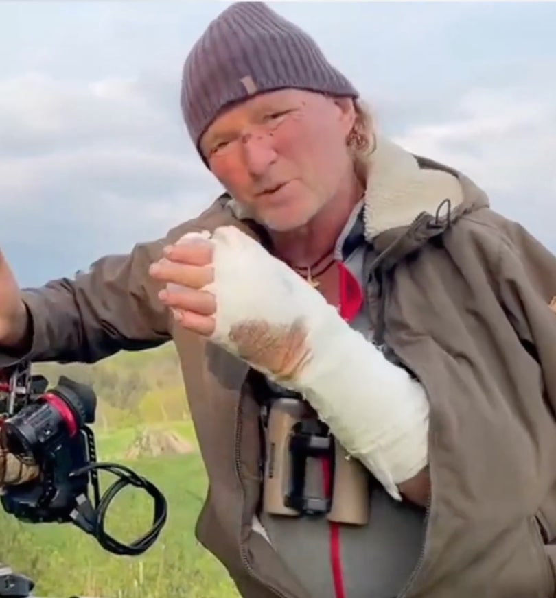 The filmmaker from Germany has been left with scars across his arms