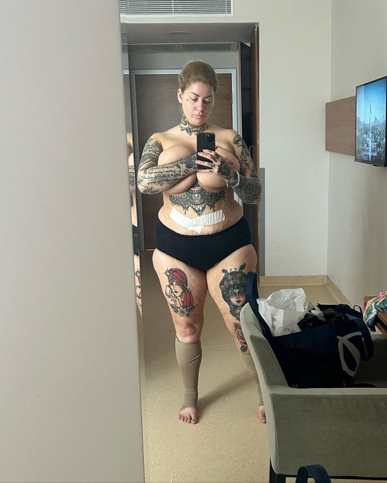 Gemma posed in just a pair of black knickers with bandages on her stomach