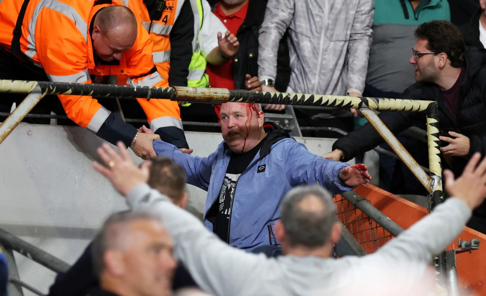 A Leeds fan was left bloodied after reportedly falling into the TV gantry