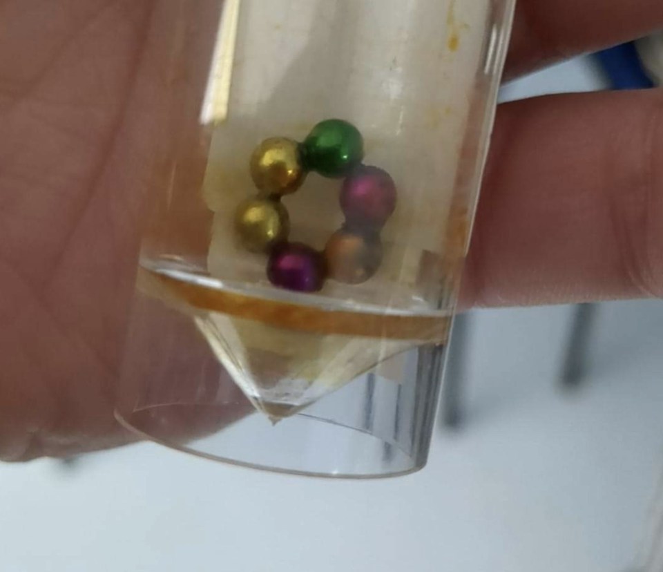 Doctors found six magnetic fidget beads in Melissa-Jayd's intestine