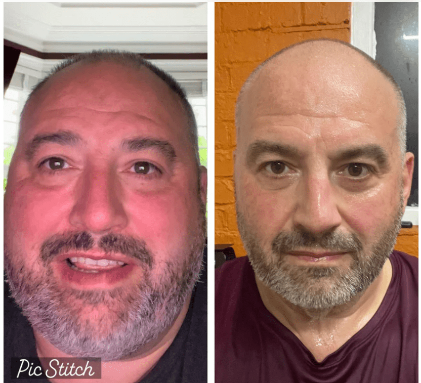 Wynne Evans shared a before and after photo and fans were stunned