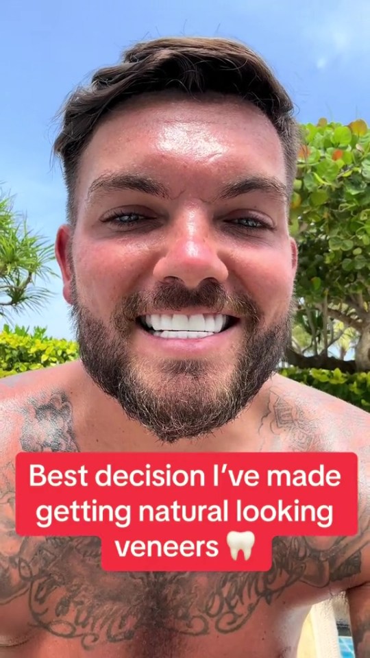 Sam Gowland has been Turkey-teeth shamed by cruel fans