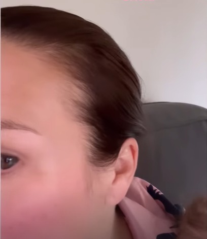 She shared a funny video with fans pointing out her receding hairline