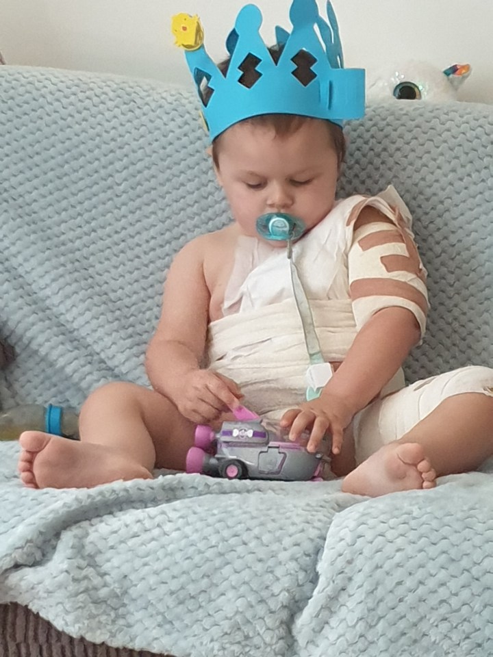 Arthur, then two, pulled a hot cafetière onto himself