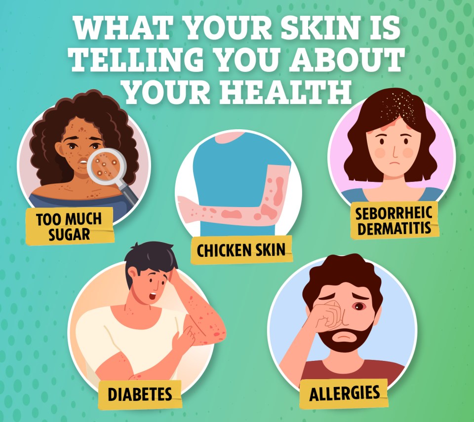 While breakouts might indicate you’re eating too much sugar, conditions like diabetes could actually take an affect on your skin, making it dry and prone to infection