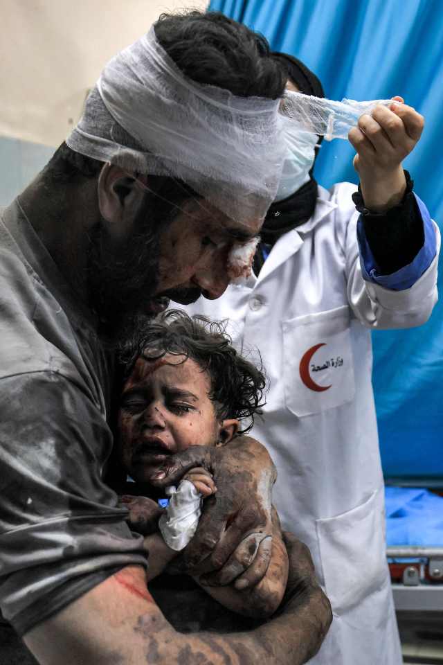 An injured man holds a wounded after an Israeli airstrike on Gaza