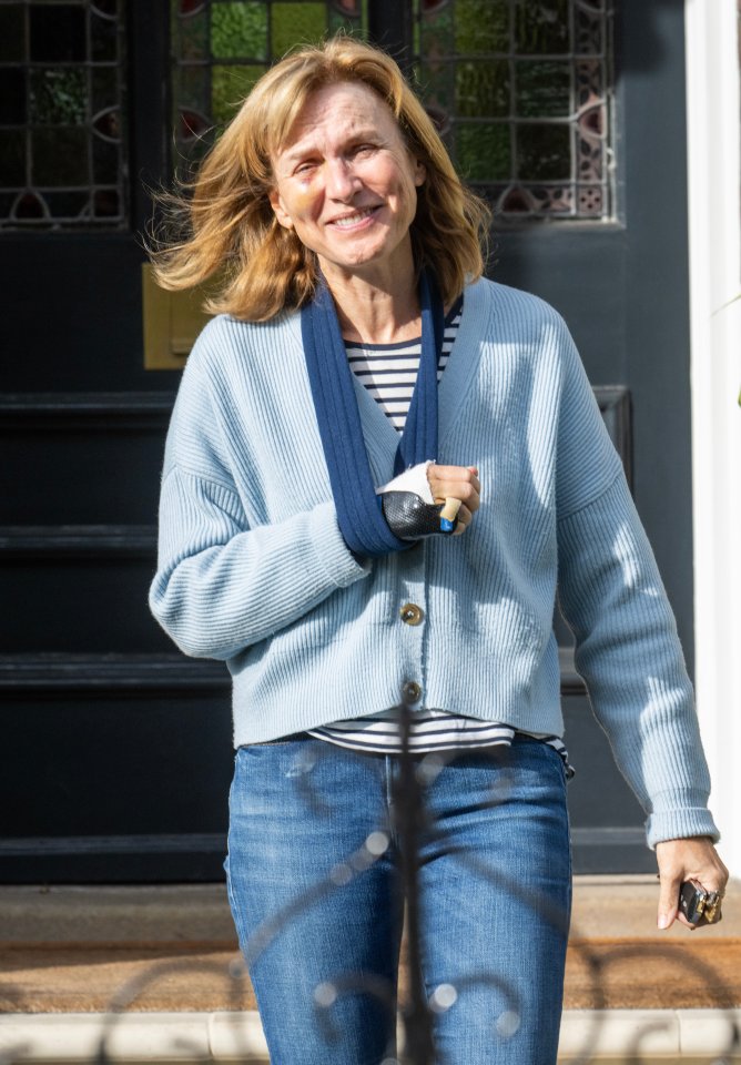 Fiona Bruce was spotted with a black eye and injured arm today