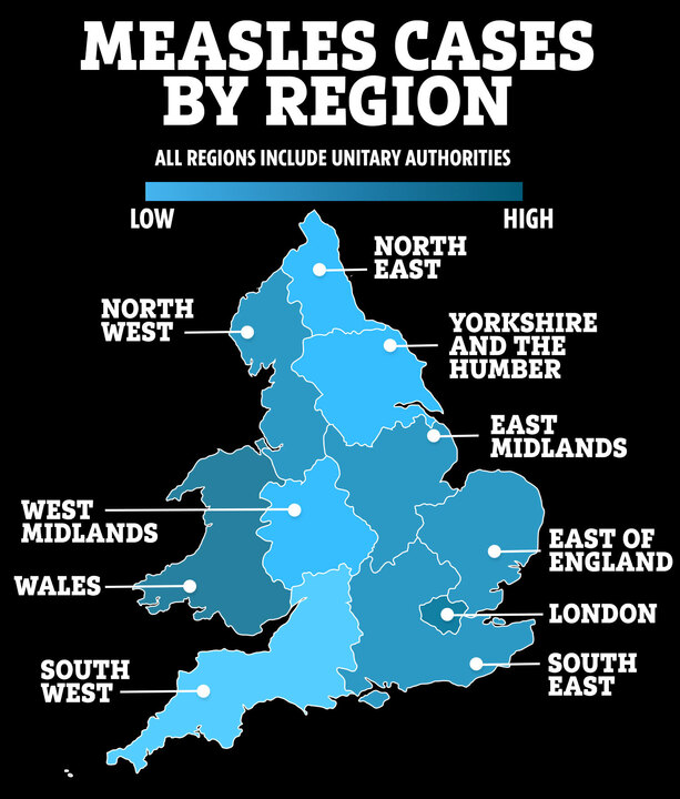 Map reveals most dangerous regions for measles