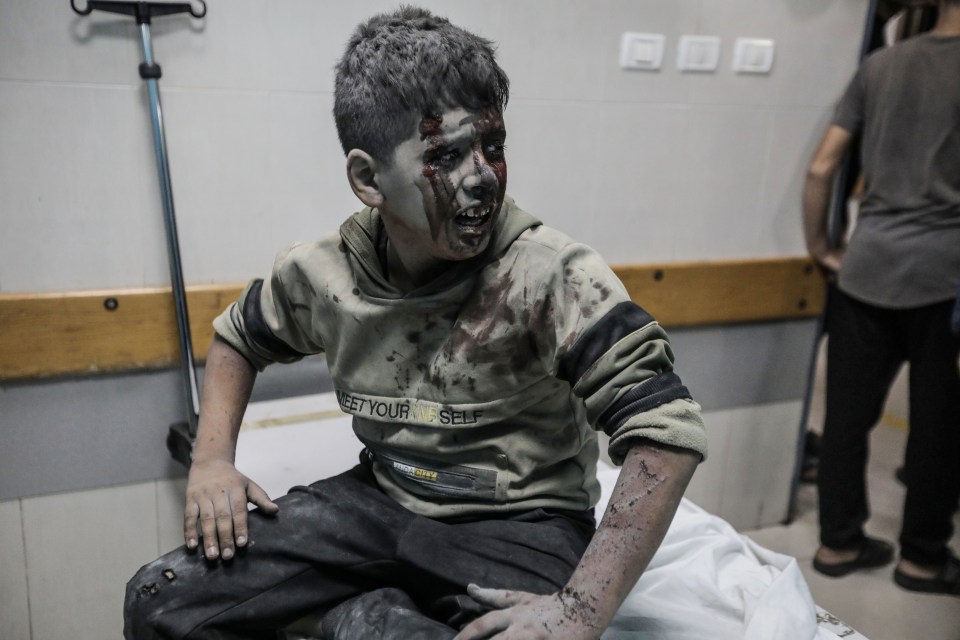 A young boy injured by Israel's raids receives treatment at a Gaza hospital