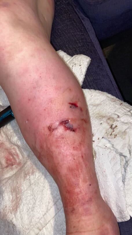 Envie savage Lynsey's leg in a horrifying attack inside their Chesterfield home