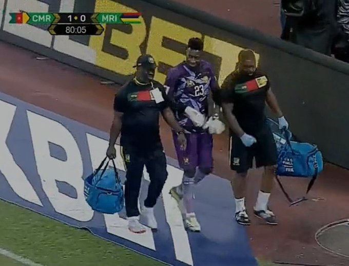 Goalie Andre Onana also limped off the field for Cameroon