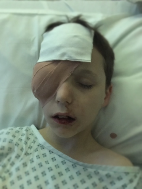 Tyler pictured in hospital after receiving surgery on his injured eye