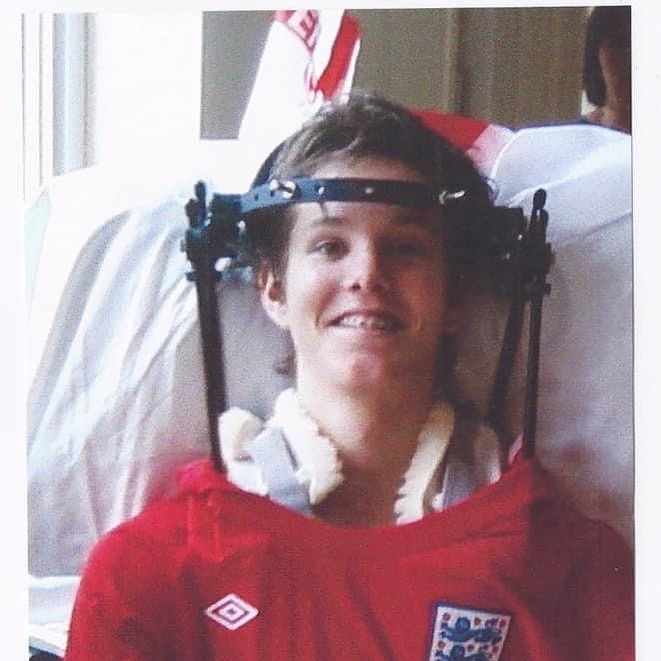 George was 17 when he suffered terrible injuries in a crash