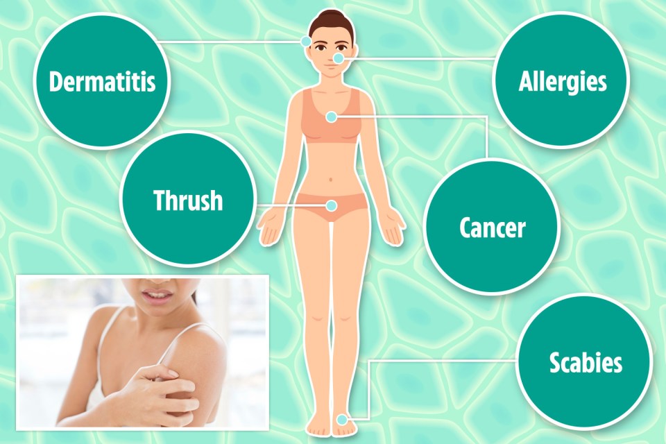 Some of the causes of itchy skin