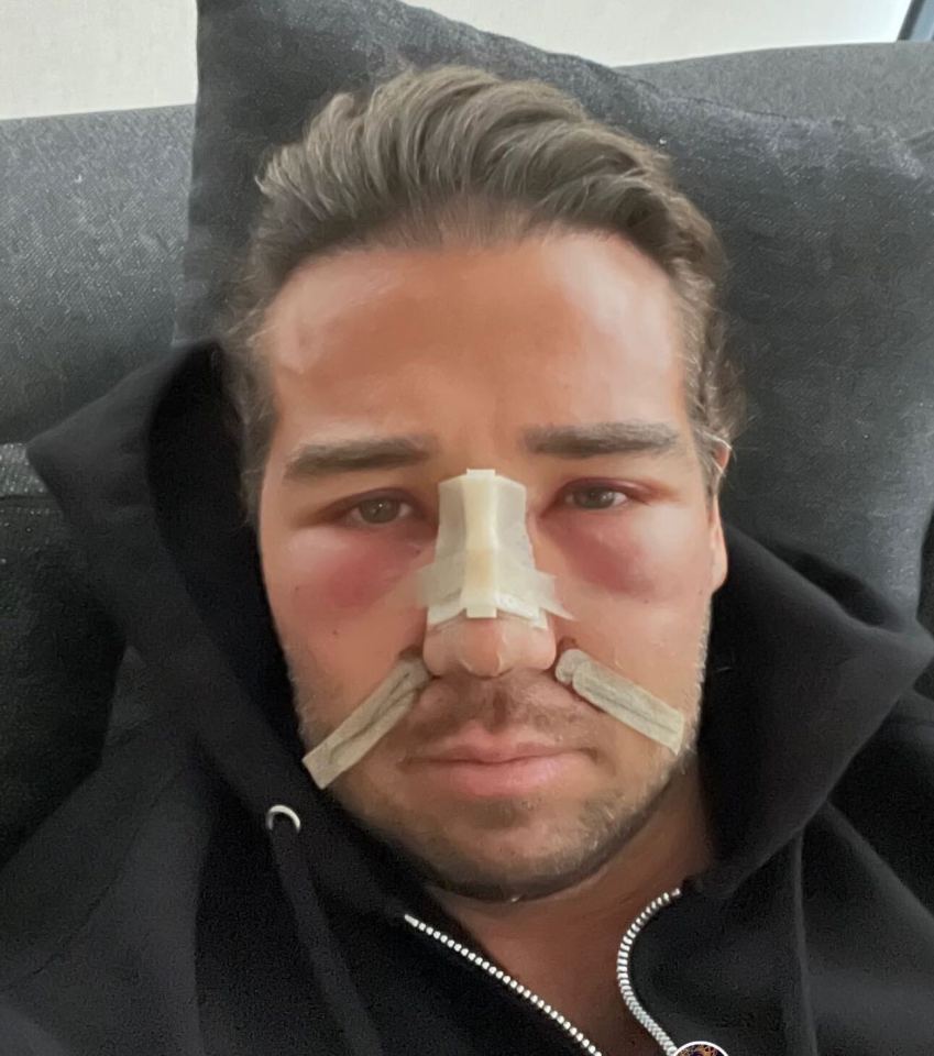 Towie star James Lock has shared a post-op photo as he recovers from surgery