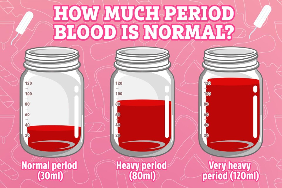 Losing 30ml of blood during a period is considered ‘normal’, more than 80ml is considered ‘heavy’