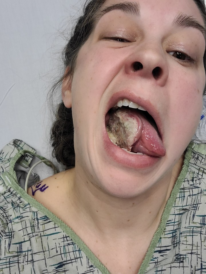 She later discovered she had stage four mouth cancer