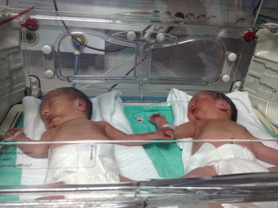 The twins together in hospital just after they were born