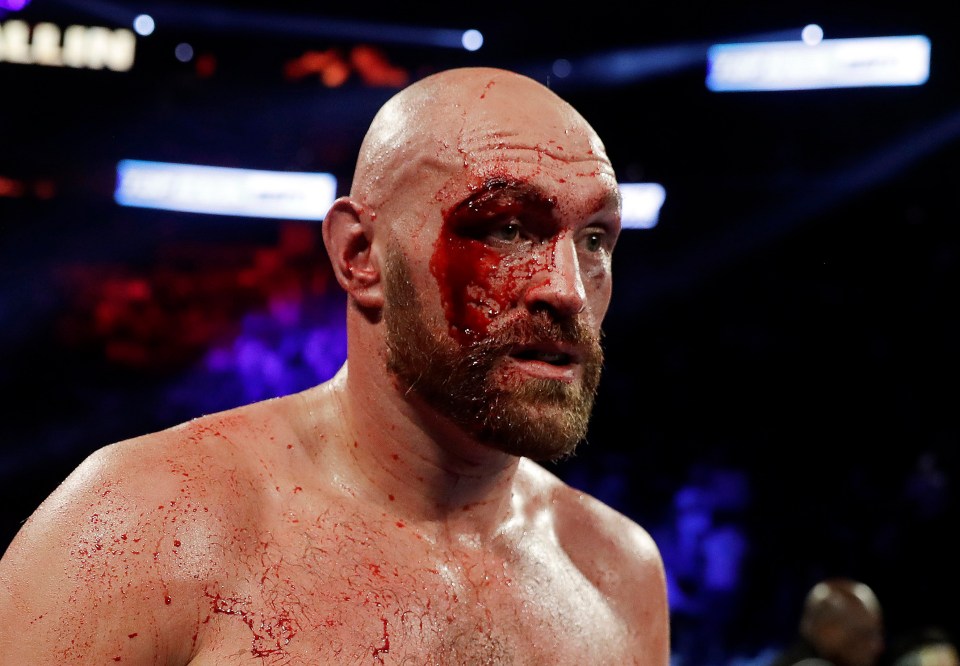 The Swede left Tyson Fury with a nasty gash in their 2019 bout