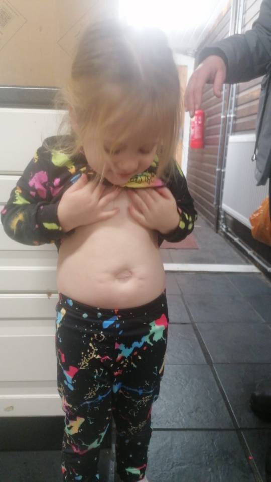 Sienna shows off her 'unusual belly button' to everyone, her mum said