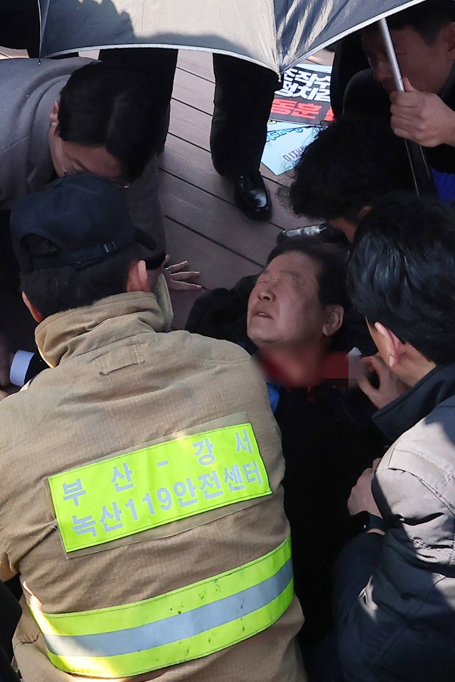 Lee receives first aid after being attacked at the construction site by a man claiming to be a fan