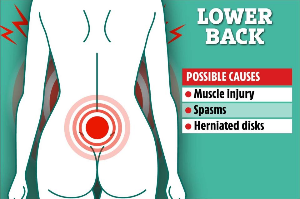 Pain in the lower back can be caused by herniated disks, spasms and muscle injuries