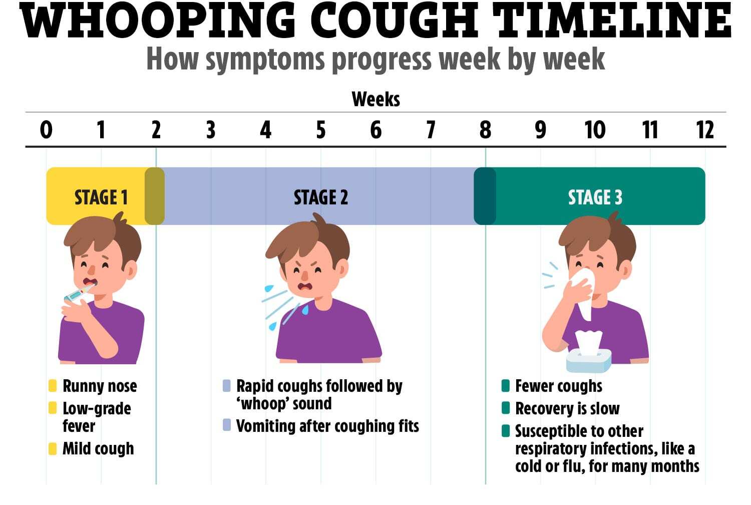 Whooping cough can start with cold-like symptoms before progressing to a hacking cough