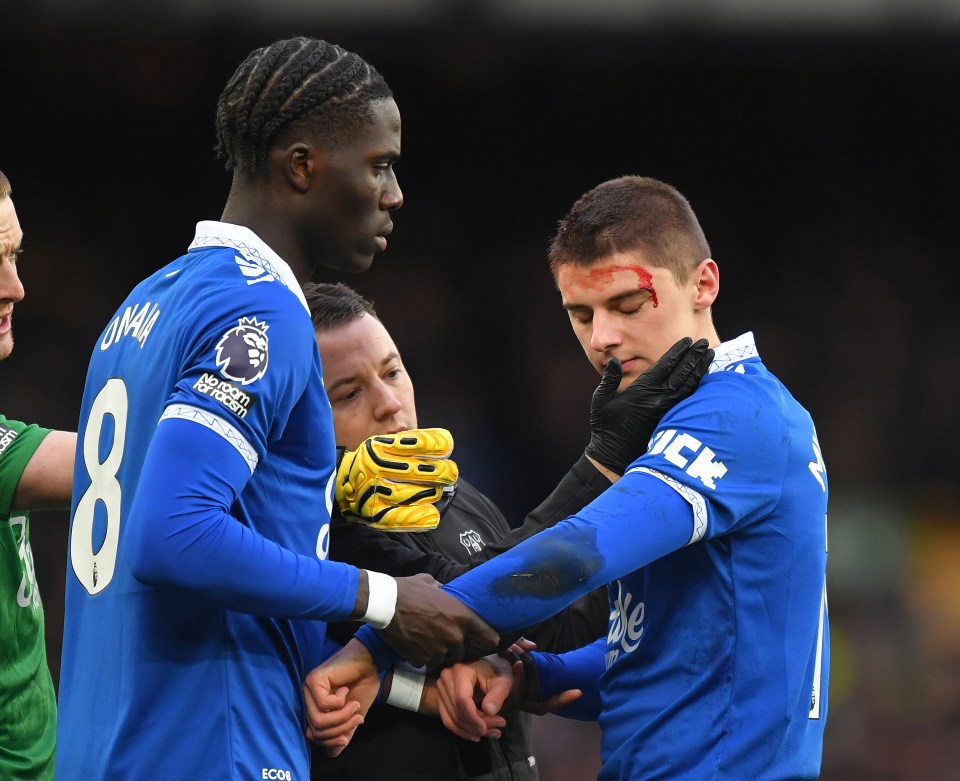 Vitaliy Mykolenko was left with a bloodied head during Everton's clash with Aston Villa