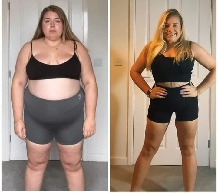 Becka Gil, 32, from Cheshire lost 100lbs after gastric sleeve surgery in Turkey