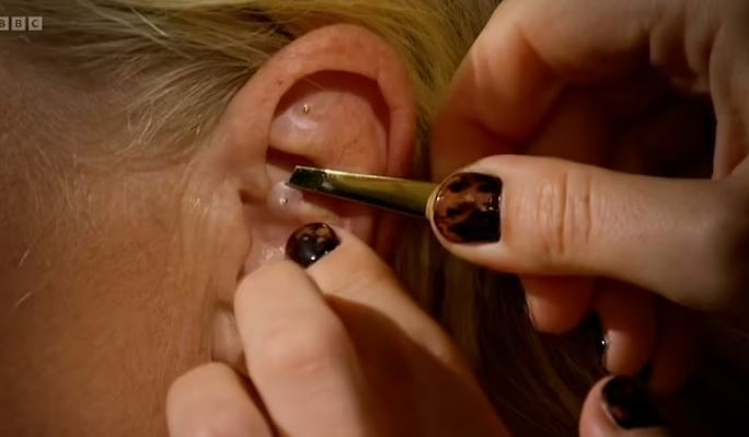 Ear seeds are small seeds used to stimulate pressure points in your ear