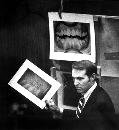 Photos of Bundy’s teeth were shown at his trial