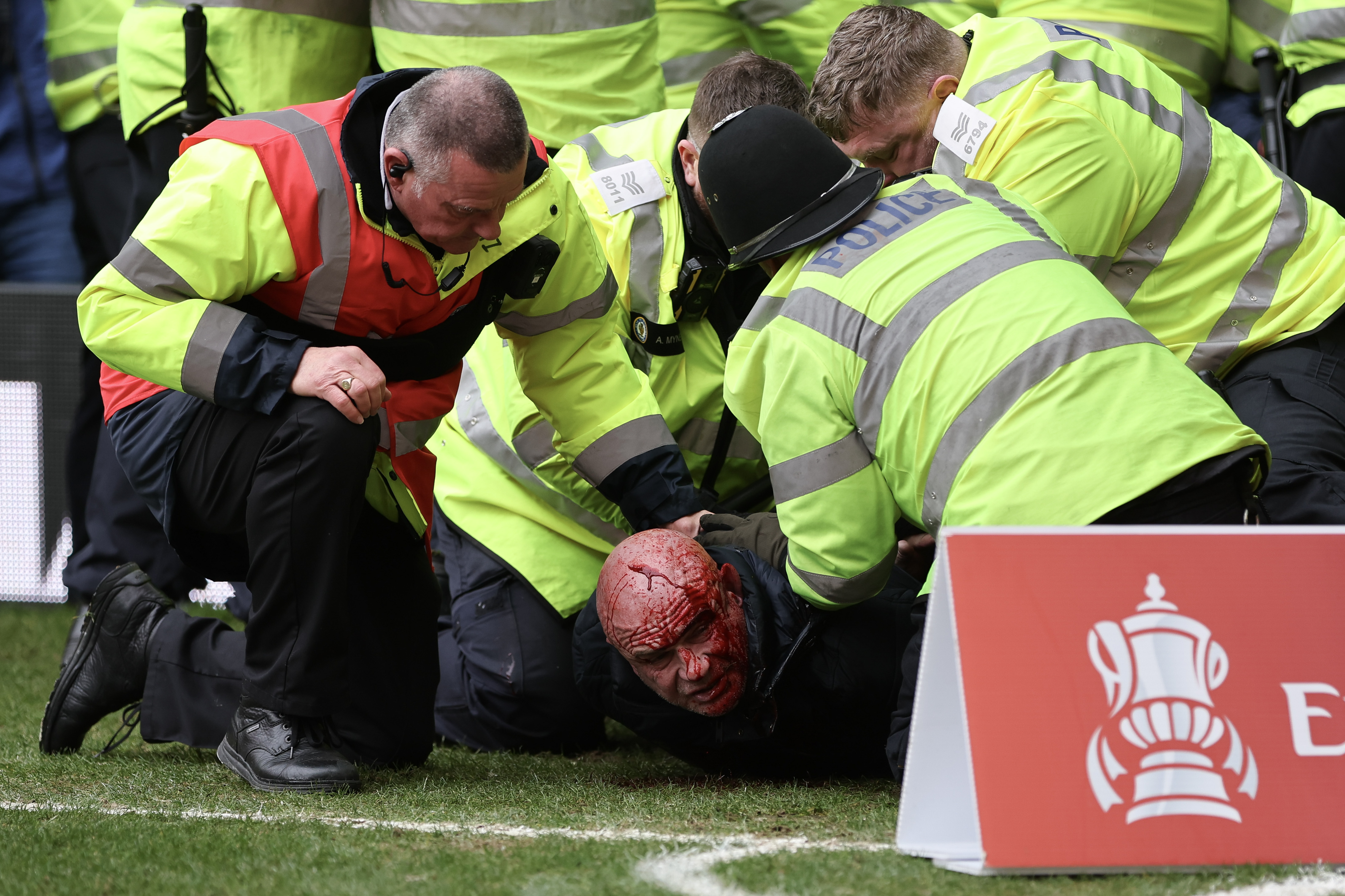 A fan was escorted out of the ground by emergency services covered in blood