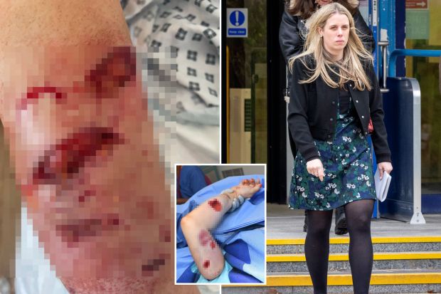 Jogger Rachel Drew suffered horrific injuries when she was attacked by a dangerous dog