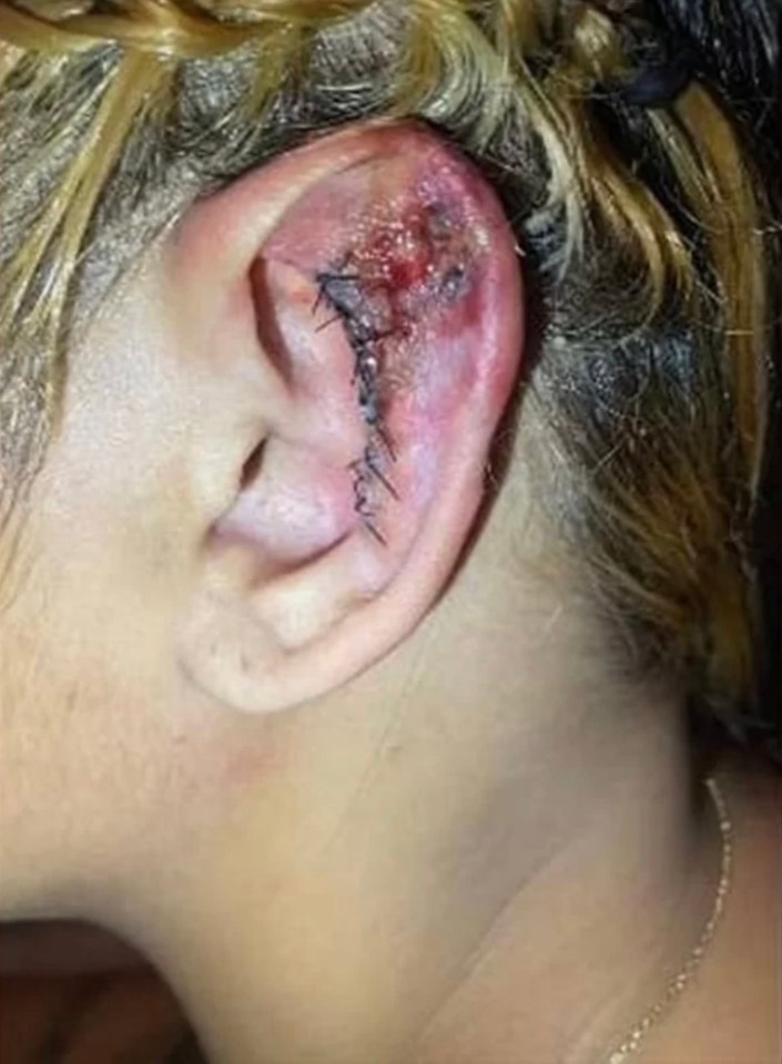 One woman's ear looks completely infected next to thick stitches reportedly following a procedure at the clinic