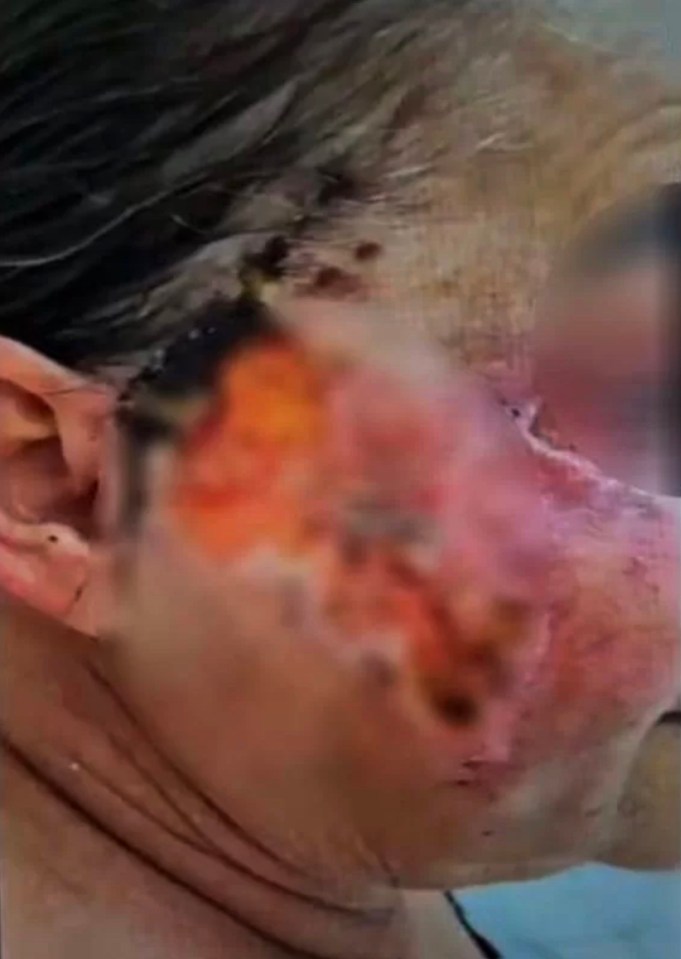 One alleged victim's whole cheek appears to be rotting after a botched face-lift