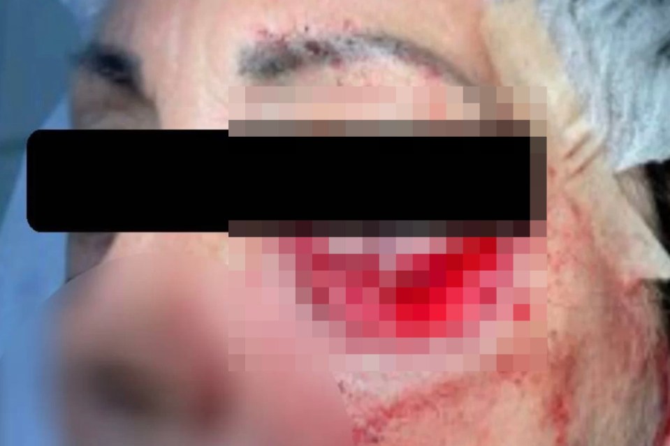 One alleged victim appeared to have her eye almost gouged out